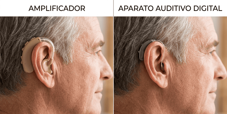 Amplificador vs aparato auditivo