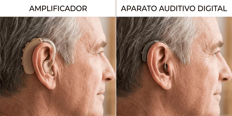 Amplificador vs aparato auditivo